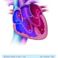 טרונקוס ארטריוזוס (Truncus Arteriosus)